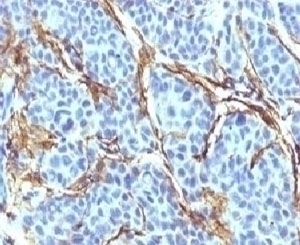 CD271 Antibody [CDLA271]