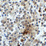 Immunohistochemistry of CD28 in human spleen tissue with CD28 antibody at 2 μg/ml.