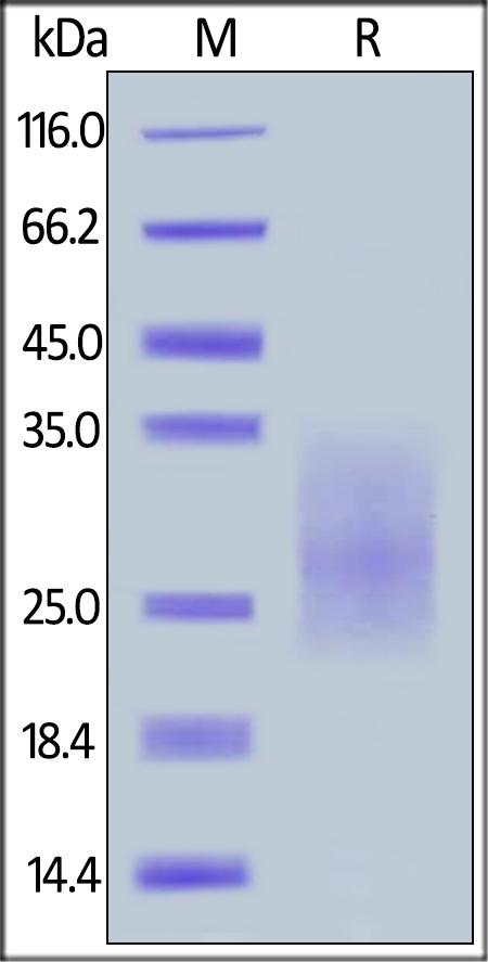 CD28H / IGPR-1 Recombinant Protein