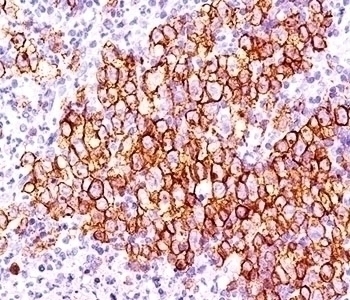 CD30 Antibody [CD30/412]