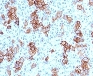 CD30 Antibody [CDLA30-1]