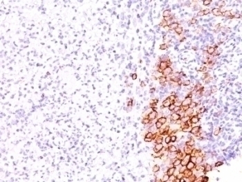 CD30 Antibody [SPM609]