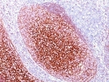 CD35 Antibody [CR1/802]