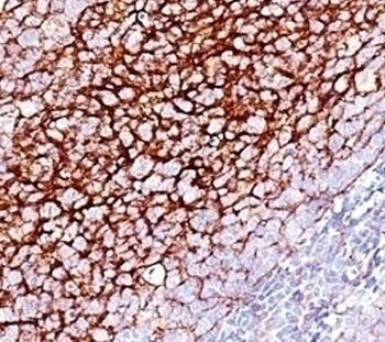 CD35 Antibody [SPM554]