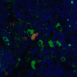 <strong>Figure 4 Immunofluorescence Validation of CD4  in Human Thymus Tissue</strong><br>Immunofluorescent analysis of 4% paraformaldehyde-fixed human thymus tissue labeling CD4 with PM-5203 at 5 μg/mL, followed by goat anti-mouse IgG secondary antibody at 1/500 dilution (green), Phylloidin staining (red) and DAPI staining (blue).