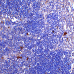 <strong>Figure 3  Immunohistochemistry Validation of CD4 in Human Thymus Tissue </strong><br> Immunohistochemical analysis of paraffin-embedded human thymus tissue using anti-CD4 antibody (PM-5203) at 5 μg/ml. Tissue was fixed with formaldehyde and blocked with 10% serum for 1 h at RT; antigen retrieval was by heat mediation with a citrate buffer (pH6). Samples were incubated with primary antibody overnight at 4°C. A goat anti-mouse IgG H&L (HRP) at 1/250 was used as secondary. Counter stained with Hematoxylin.