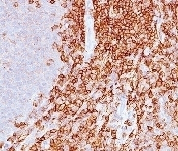 CD43 Antibody [DF-T1]