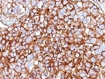 CD44 Antibody [HCAM/918]