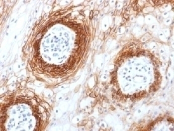 CD44v6 Antibody [CD44v6/1246]