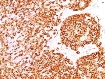 CD45 Antibody [PTPRC/1460]
