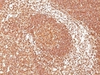 CD45 Antibody [PTPRC/1461]