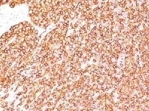 CD45 Antibody [SPM570]