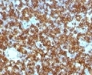 CD45RA Antibody [PTPRC/1131]