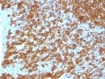 CD45RA Antibody [PTPRC/1148]