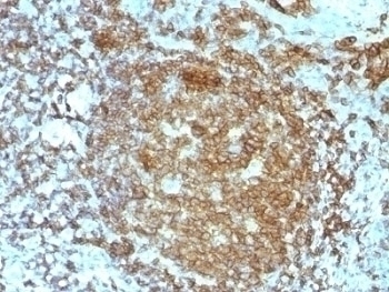 CD45RA Antibody [PTPRC/818]
