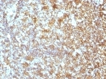 CD45RA Antibody [SPM504]