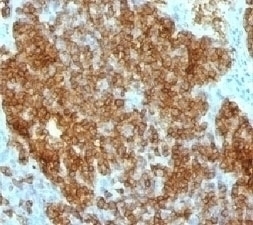 CD45RA Antibody [SPM568]