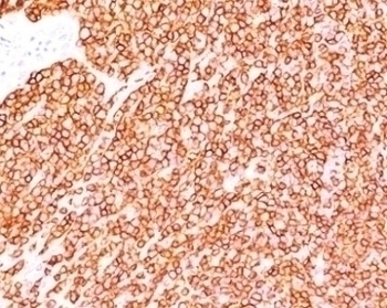 CD45RB Antibody [BRA-11]