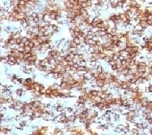 CD45RB Antibody [CDLA45RB-1]