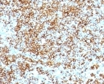 CD45RB Antibody [SPM569]