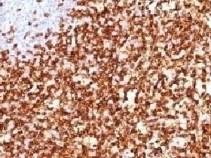 CD45RO Antibody [CDLA45RO-1]