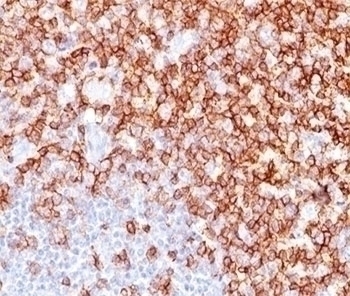 CD45RO Antibody [UCHL-1]