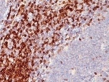 CD5 Antibody [C5/473]