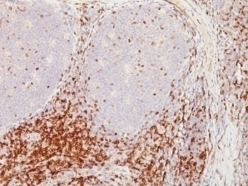 CD5 Antibody [CD5/54/F6]