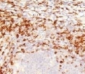 CD5 Antibody [CLDA5-1]