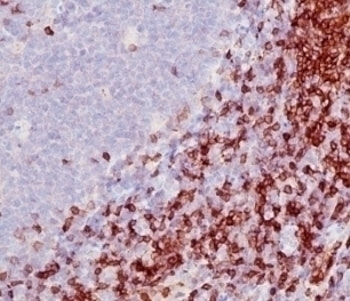 CD5 Antibody [SPM546]