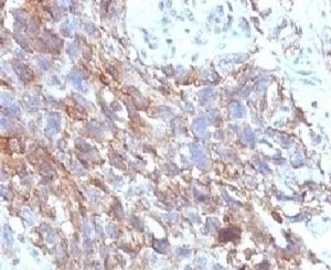 CD56 Antibody [CDLA56]
