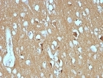 CD56 Antibody [SPM128]