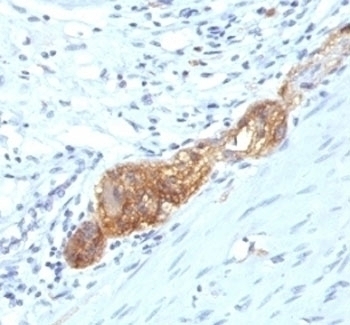 CD56 Antibody [SPM489]