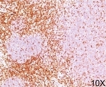 CD6 Antibody [3F7B5]