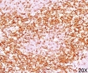 CD6 Antibody [C6/372]