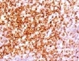 CD6 Antibody [CLDA6-1]