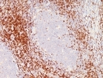 CD6 Antibody [SPM547]