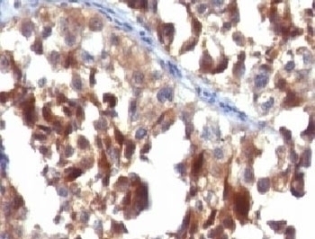 CD63 Antibody [CDLA63-1]