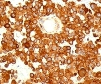 CD63 Antibody [MX-49.129.5]