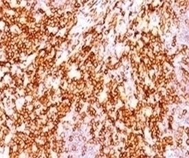 CD68 Antibody [LAM34-1]