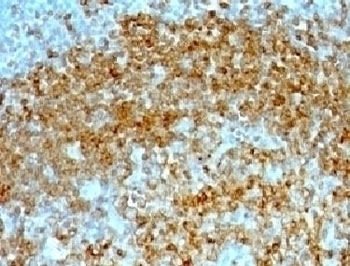 CD74 Antibody [CDLA74-1]
