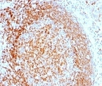 CD74 Antibody [LN-2]