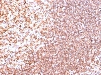 CD74 Antibody [SPM523]