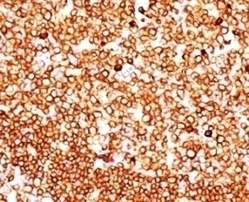 CD79 Antibody [SPM549]