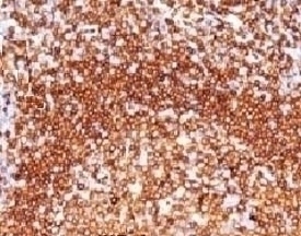 CD79a Antibody [CDLA79a-1]