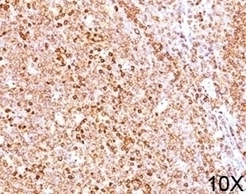 CD79a Antibody [HM47/A9]