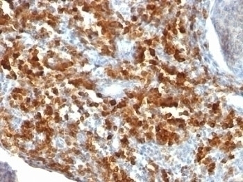 CD79a Antibody [IGA/515]