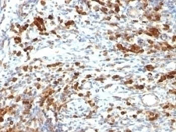 CD79a Antibody [IGA/764]