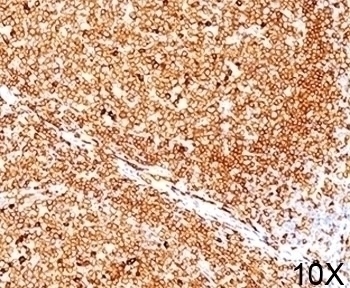 CD79a Antibody [JCB117]