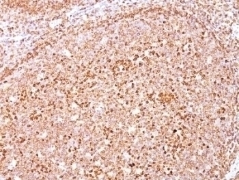 CD79a Antibody [SPM550]